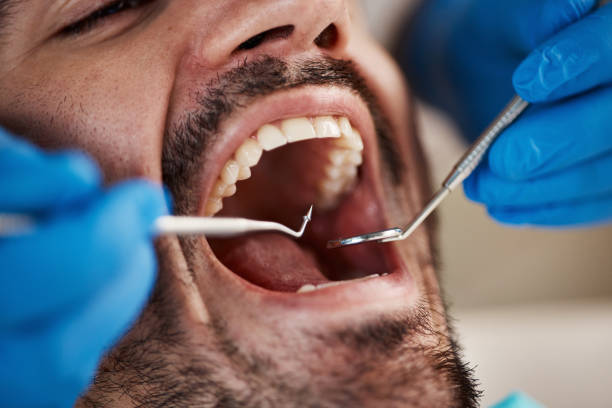 Best Emergency Dental Services for Seniors in Jamestown, NC