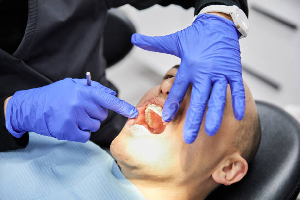 Best Emergency Dentist for Knocked-Out Tooth in Jamestown, NC